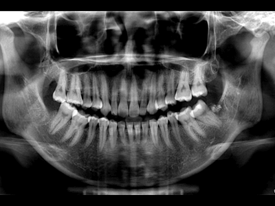 Insights Diagnostic CBCT Scan Services Digital Panoramic